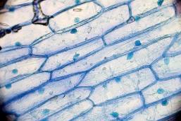 La membrana plasmatica Di tutte le membrane possedute da una cellula, la membrana plasmatica è di gran lunga la più importante perché: 1.