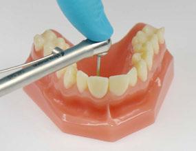 6.9 Inserimento (studio dentistico) Fissare il restauro finale sul modello master prima di inviarlo al dentista. Verificare il fissaggio corretto del restauro sul modello master o sull'analogo.
