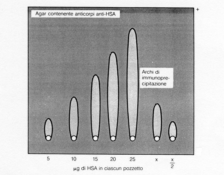 ROCKET IMMUNOELETTROFORESI Tecnica di adattamento dell immunoelettroforesi radiale semplice; prevede la migrazione dell Ag dai pozzetti incisi nel gel