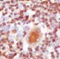 linfociti; denso in fase