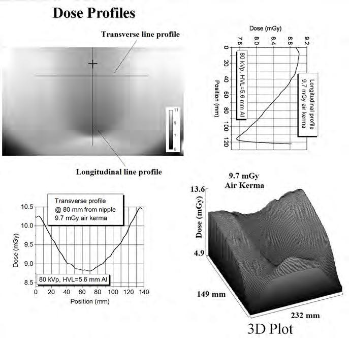 distribution of the PMMA breast phantom irradiated with a 80 kvp