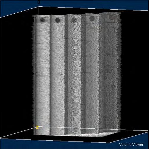 Phase-contrast tomography Phase-retrieval