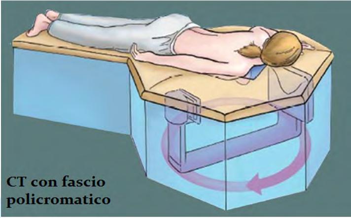 di centinaia di proiezioni Ricostruzione 3D dell