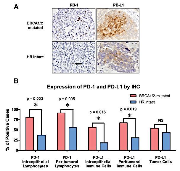 BRCA1/2-mut HGSOCs more sensitive to PD- 1/PD-L1 inhibitors compared to HR-proficient?