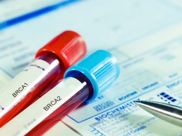 Il test BRCA Il test BRCA è l analisi eseguita a partire da un campione biologico (sangue o tessuto tumorale) che consente di esaminare questi geni per capire se è presente un alterazione in grado di