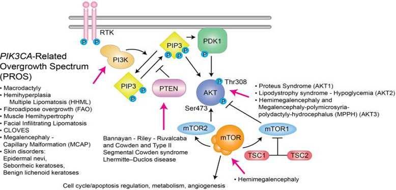 Somatic Overgrowth Disorders Associated With PI3K/AKT/ mtor