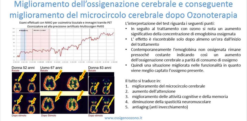 Ozonoterapia: