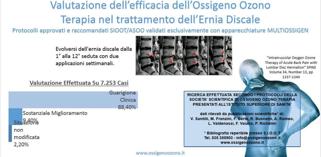 Ozonoterapia: