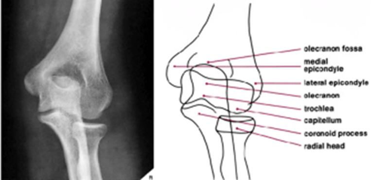 6 3. PROIEZIONI STANDARD DEL GOMITO PROIEZIONE ANTERO-POSTERIORE INDICAZIONI= in traumatologia, studio epicondiliti, nelle malattie articolari in genere.