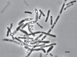 Bacillus cereus sensu lato