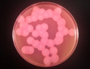 Identificazione di Bacillus cereus METODI COLTURALI SU TERRENI SELETTIVI Terreno MYP: