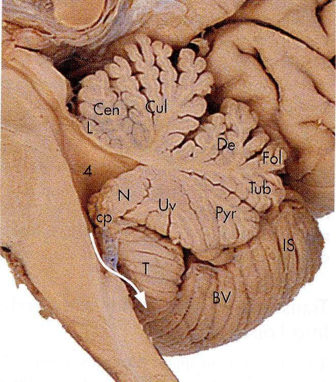 Immagine tratta da: The Human Brain, J.