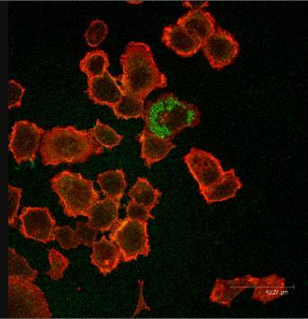 costituita da uno o più laser per ogni diversa frequenza di