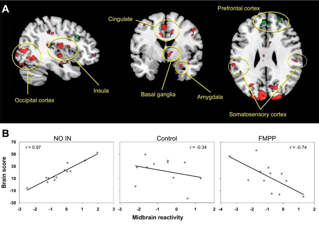 Consumption of Fermented Milk Product With Probiotic Modulates Brain Activity Conclusioni : L'assunzione per quattro settimane di un FMPP da parte di donne sane ha