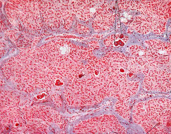 capillari sinusoidi e sintetizzano l ormone melatonina,