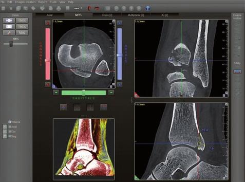 Le immagini 3D possono essere importate e utilizzate in innumerevoli modi diagnostici e