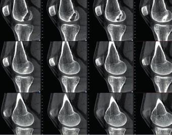 vertebrale e di anomalie cervicali.