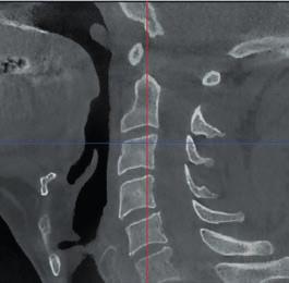 parametri radiologici adeguati, in modo da