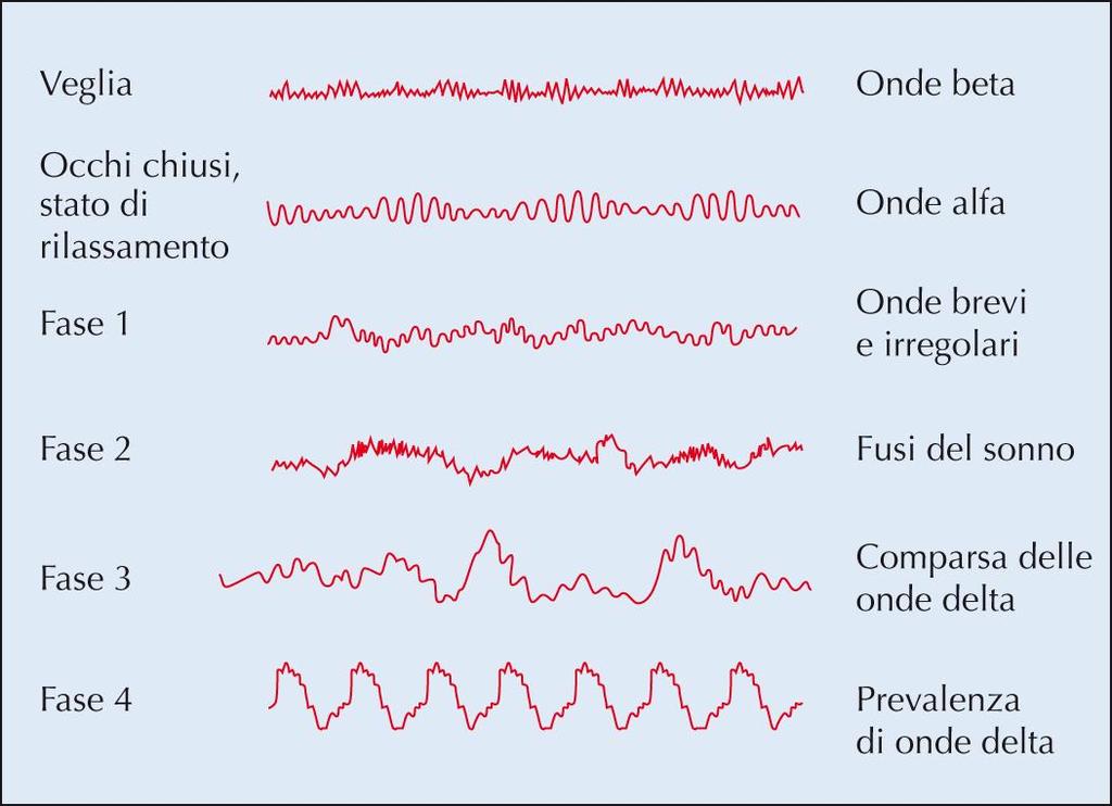 Cambiamenti nei pattern di onde cerebrali associati alle varie fasi del sonno.