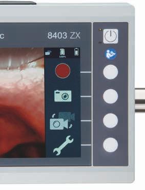 re del sistema C-MAC Video-endoscopi d intubazione flessibile