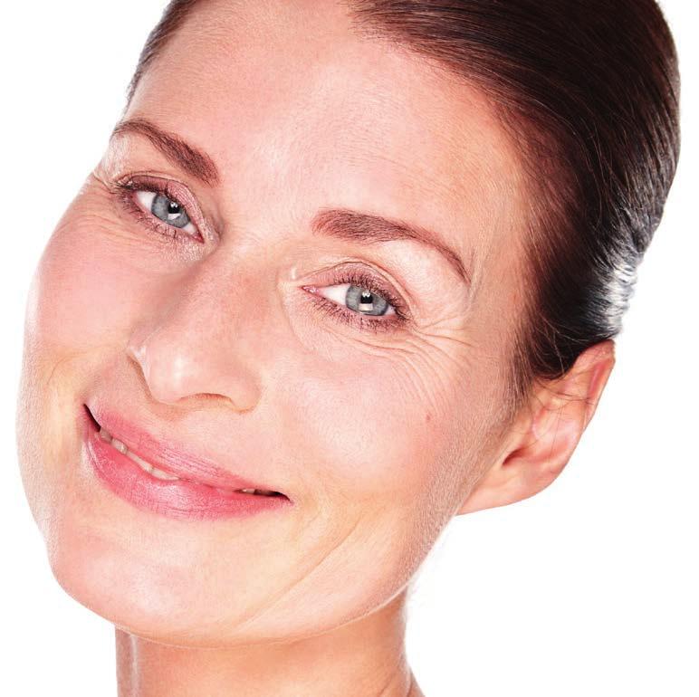 DermalStyle Smile (con lidocaina) contiene acido ialuronico cross-linkato ed è indicato per la correzione del contorno labbra o per l aumento di volume delle stesse; la sua speciale formulazione è
