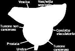 SORVEGLIANZA IN ALTRI ORGANI?