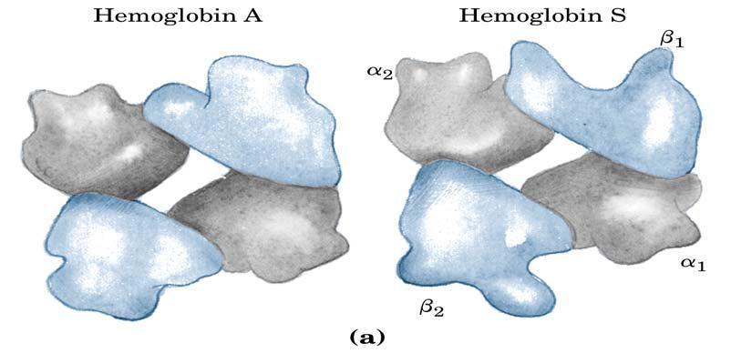 IL CONFRONTO TRA HbA (NORMALE) ED HbS (ANEMIA FALCIFORME) L anemia a cellule falciformi é una malattia molecolare.