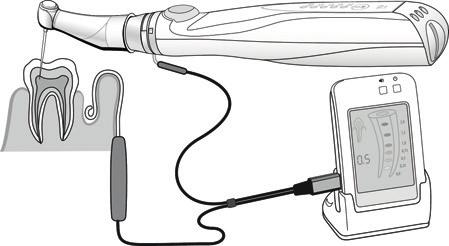12. Collegare lo strumento al misuratore endodontico Con la clip S5 Apex del motore endodontico S5 è possibile collegare un cavo di misurazione per misuratore endodontico al contrangolo del motore