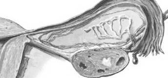 TUBE UTERINE Ciascuna salpinge costa di 3 segmenti : - la porzione ampollare con il padiglione munito di frange (fimbrie) la più lunga delle quali, fimbria ovarica, prende rapporto col polo laterale