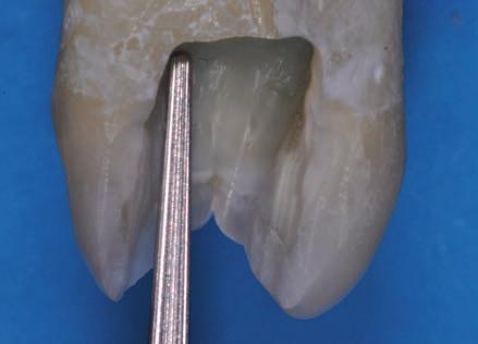 all Endodonzia: quello che l