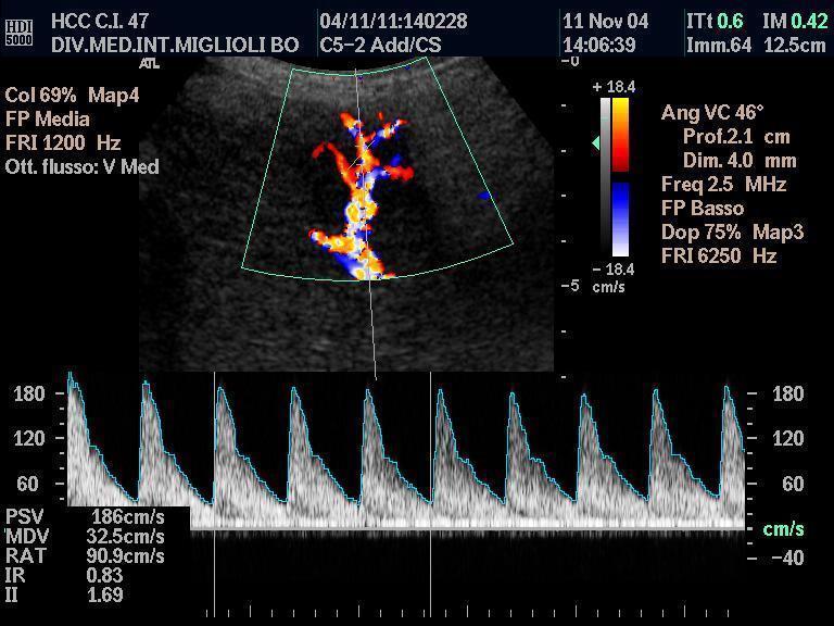 L analisi spettrale Doppler