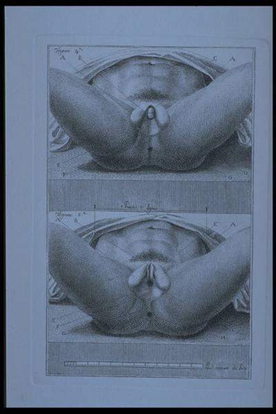 Studio anatomico dell'ermafrodito Giacoma Fiorini Viviani, Giuseppe; Campi, Felice Link risorsa: http://www.