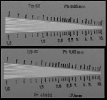 segnale/rumore e quindi migliora la risoluzione di contrasto Upper row: relative dose 00% Lower row: relative dose