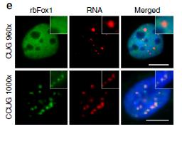 E stata identificata la proteina rbfox1 che interagisce con l RNA tossico contenente le