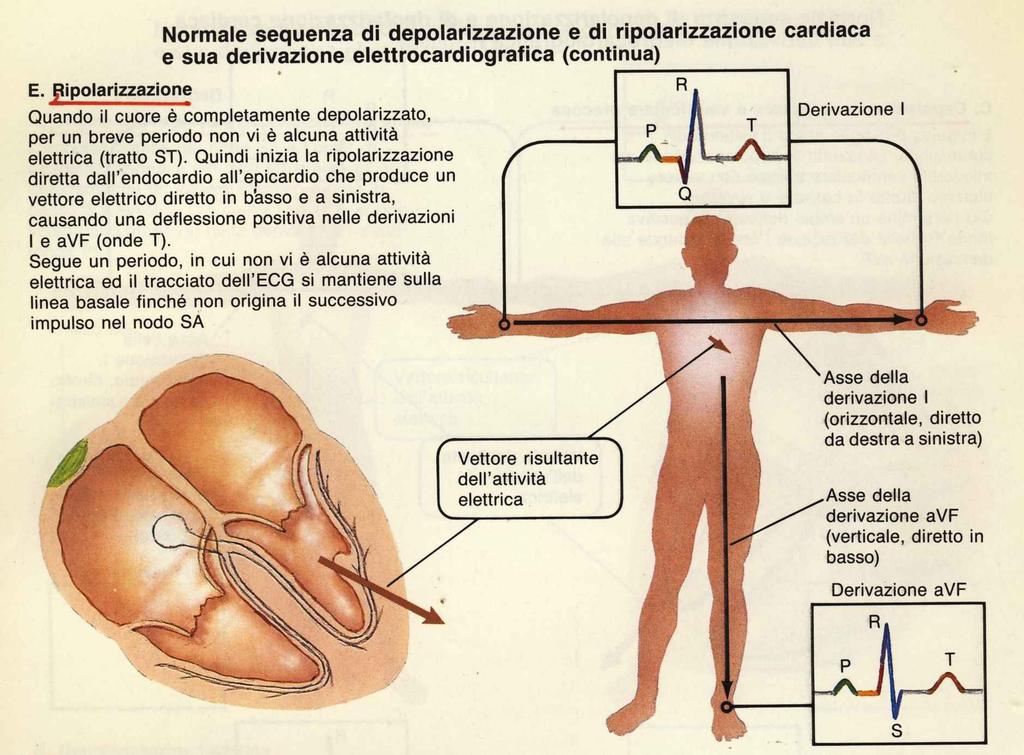 8.4 Tratto ST Rappresenta il periodo in cui le cellule ventricolari sono tutte depolarizzate e pertanto non sono rilevabili movimenti elettrici.