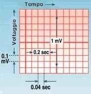 8 Tracciato elettrocardiografico Il tracciato ECG viene compilato su carta millimetrata per rendere possibile effettuare alcune misurazioni.