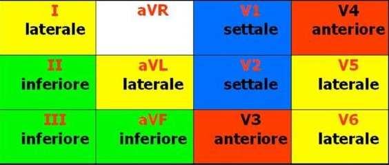 In base alle derivazioni dove si riscontrano le alterazioni si riesce a intuire la zona colpita da IMA In genere se ST-sopra in certe derivazioni, si riscontra ST-sotto nelle derivazioni opposte ECG