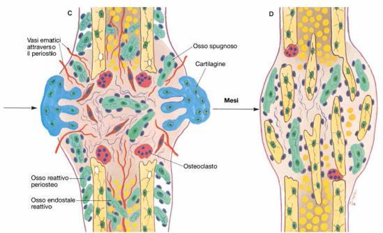 A questo punto vengono richiamate o si formano dai miofibroblasti le cellule condrocitarie, responsabili della deposizione di ECM ricca di collagene di tipo II e X; la composizione della ECM risulta