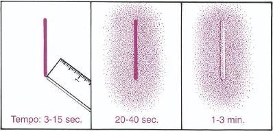 Monociti: numericamente meno numerosi, hanno vita lunga e possono anche proliferare; sono divisi in monociti circolanti, grosse cellule dal grande nucleo e dal citoplasma grigiastro ricco di granuli