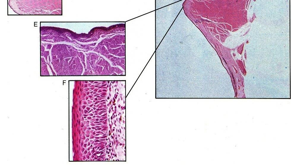 Legamento vocale Muscolo vocale