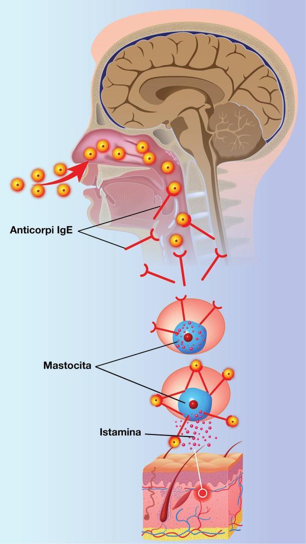 Allergie alimentari L allergia è una reazione esagerata del sistema immunitario, che si scatena in risposta ad un allergene.