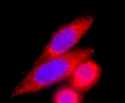 Metodi: I campioni sono stati analizzati mediante Western Blot, Immunofluorescenza e