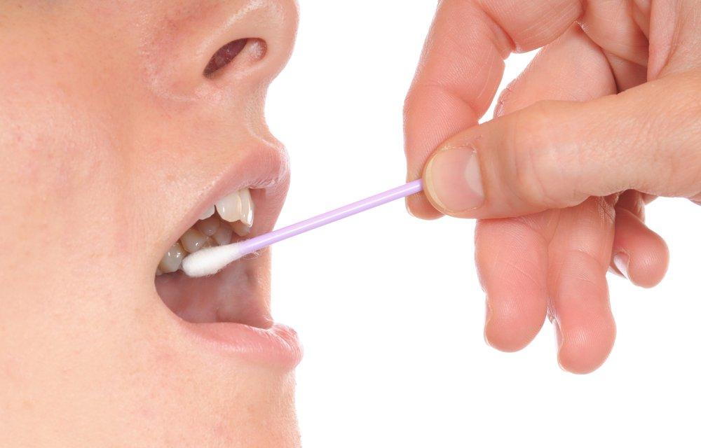 Metodologia: tampone salivare per lo screening anti HCV Si effettua passando una volta sulle gengive superiori e inferiori un piccolo tampone Fornisce il risultato nell arco di 30 minuti Come