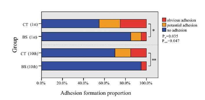 approach to open thyroidectomy: a randomized clinical