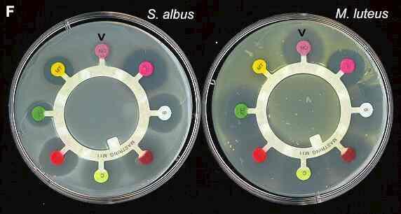 ANTIBIOTICI: test di Kirby-Bauer o antibiogramma Importante sia in terapia sia per applicazioni di microbiologia