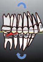 ortodontista ampi margini di scelta applicativa.