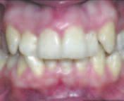 Am J Orthod Dentofacial Orthop. 2008;133:721-8 2.