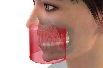 Il volume a forma di arco mandibolare mostra la zona diagnosticamente