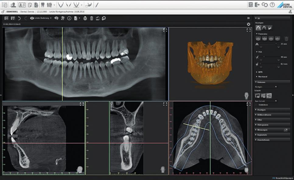 VistaSoft: la centrale diagnostica del vostro studio Il VistaSoft di Dürr Dental unisce le funzionalità d acquisizione di riprese radiografiche 3D e 2D, così come di immagini eseguite con la