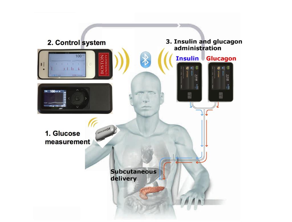 IL PANCREAS